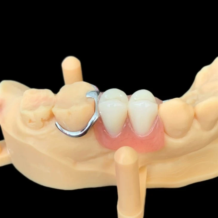 Dental Unilateral CoCr Metal Framework Partial Denture