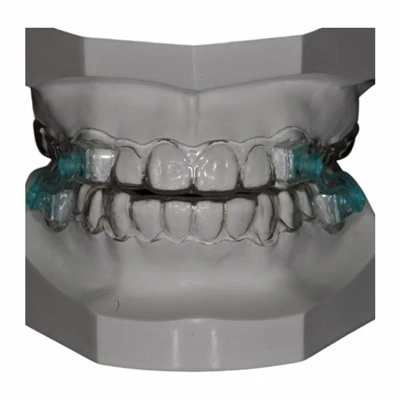 Anti-Snoring Device Dental Lab