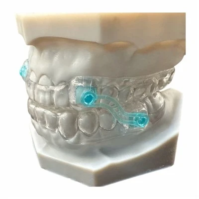 Anti Snoring Device To Prevent Snoring