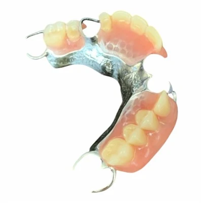 Cobalt Chrome Metal Framework Partial Denture
