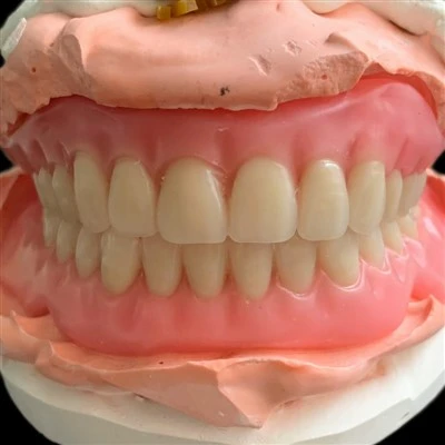 Dental Complete Acrylic Denture Set Up With Teeth Try In