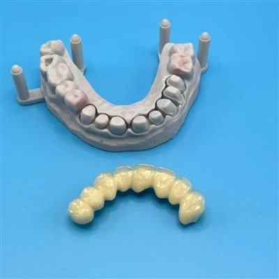 Dental Fixed Cobalt Chrome PFM Bridge
