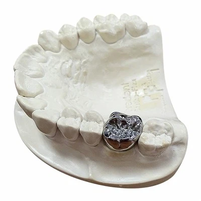 Dental Full Cobalt Chrome Crown
