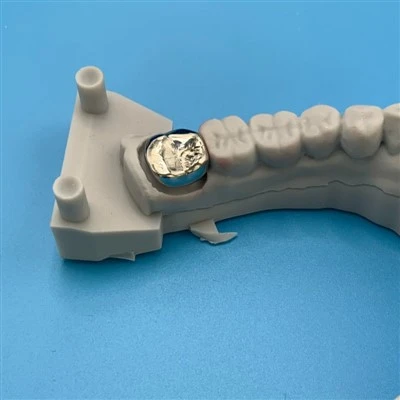 Dental Full Metal Crown