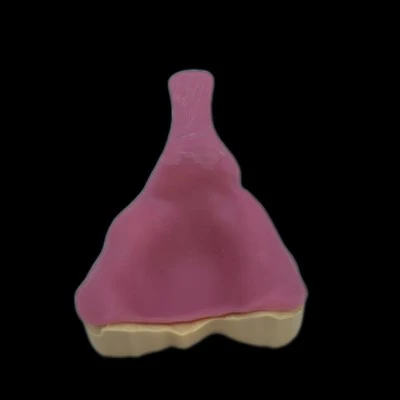Dental Impression Tray