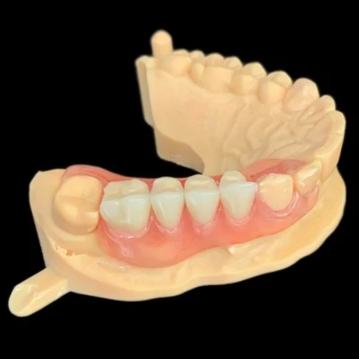 Dental Removable Partial Flexible Denture