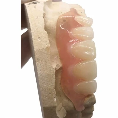Dental RPD Flexible Partial Dentures
