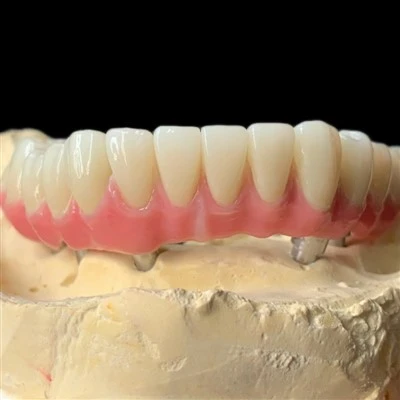 Dental Zirconia All On 6