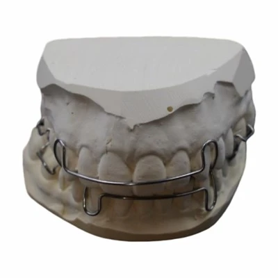Hawley Retainer Band and Loop