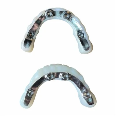 Implant Full Mouth Zirconia Bridge with Ti Bar