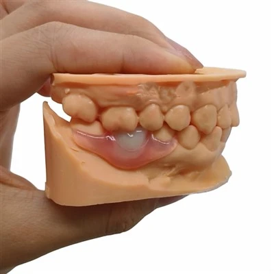 Nesbit Valplast Denture