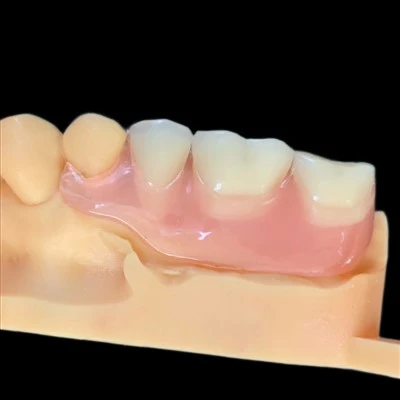 No Metal Clasp Flexible Partial Denture