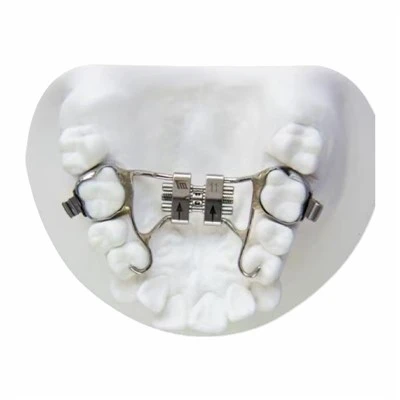 Palatal Expander Rapid Maxillary Expansion Appliance