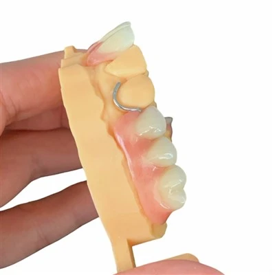 Partial Acrylic Denture with Wrought Clasp