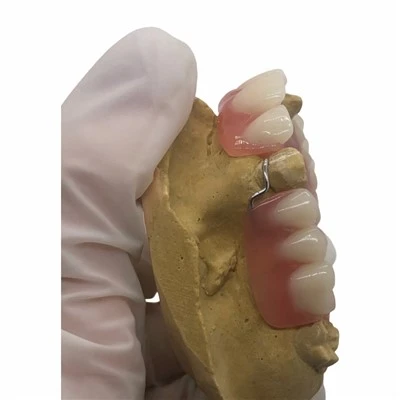 Partial Acrylic Denture