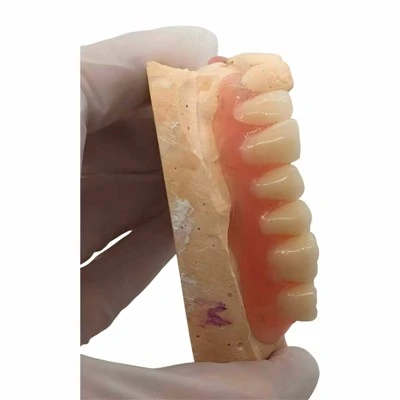 Partial Valpalst Dentutre