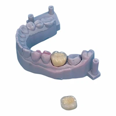 PFM CoCr Crown