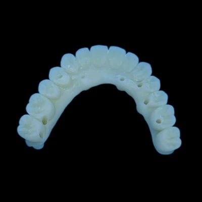 PMMA Temporary Dental Bridge