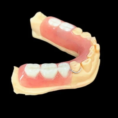 Acrylic Resin Denture