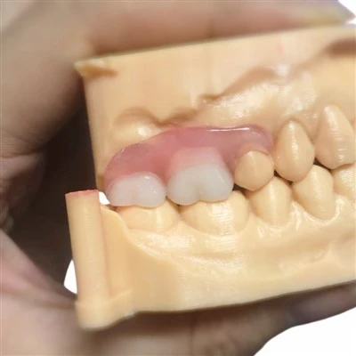 RPD Valplast Denture